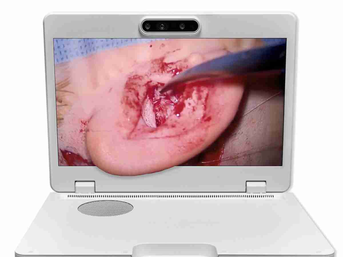 达擎之＂Heads-up 3D显微手术显示系统＂，，整合4K裸眼3D显示及眼球追踪系统，，具备快速追踪人眼移动位置功能，，，，减轻医师长时间维持固定姿势的负担，，，让医师能有更宽广清晰的3D立体视野及更舒适的姿势来执行手术。。。。